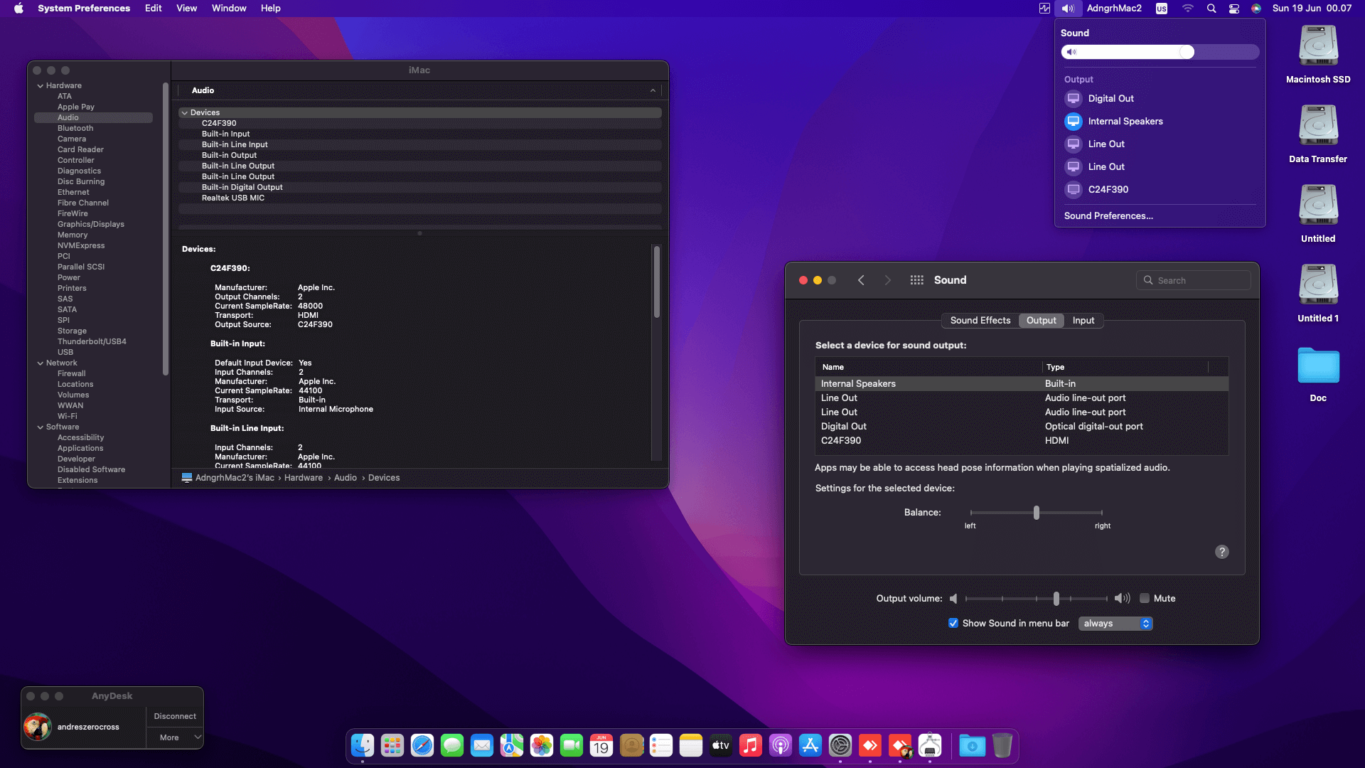 Asus ROG Strix Z490i Gaming + Intel Core i5 10400 + Sapphire RX 580 OpenCore 5